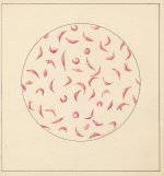 Un dibujo de los glóbulos rojos anormales (falciformes) por Roger Hayward, ca. 1964.